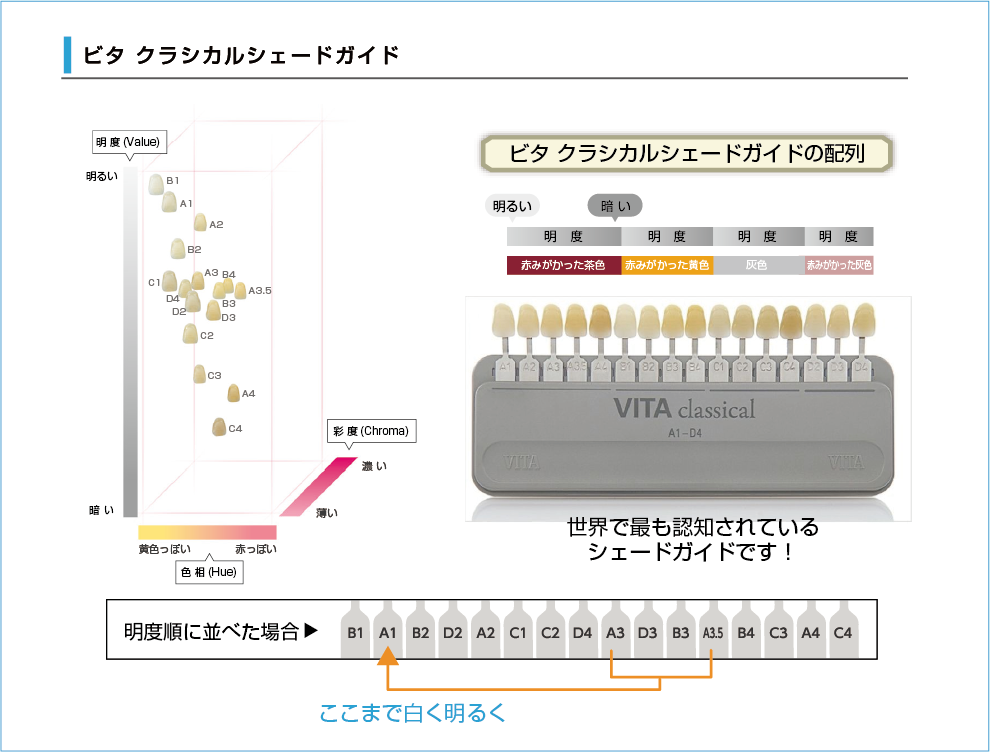 VITAシェードガイド